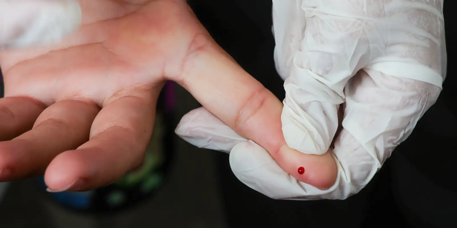 SUS passa a oferecer teste rápido para diagnóstico da dengue