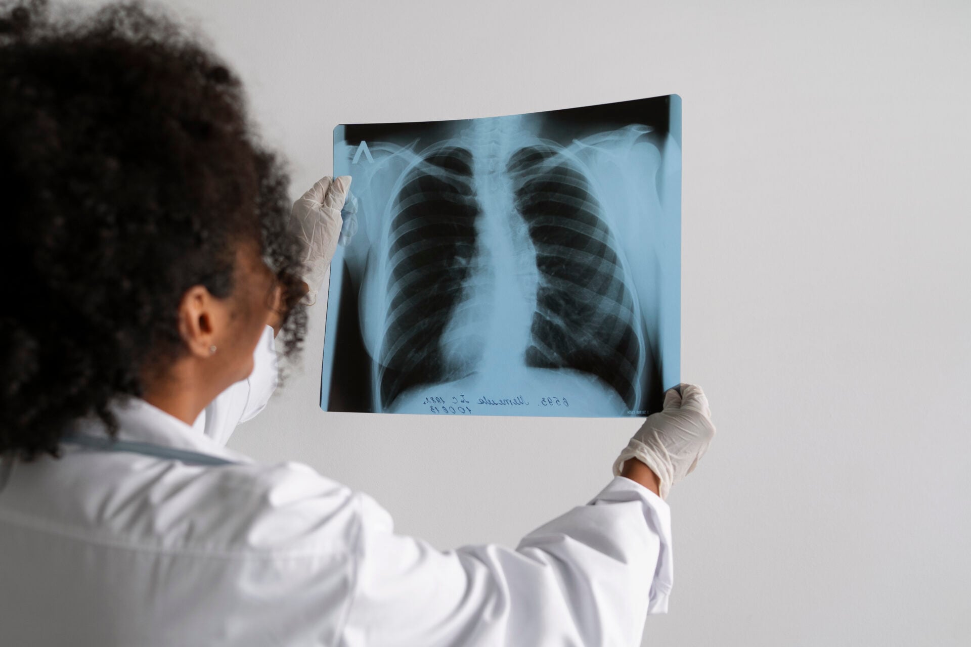 Diagnóstico tardio reduz chances de cura do câncer de pulmão no Brasil