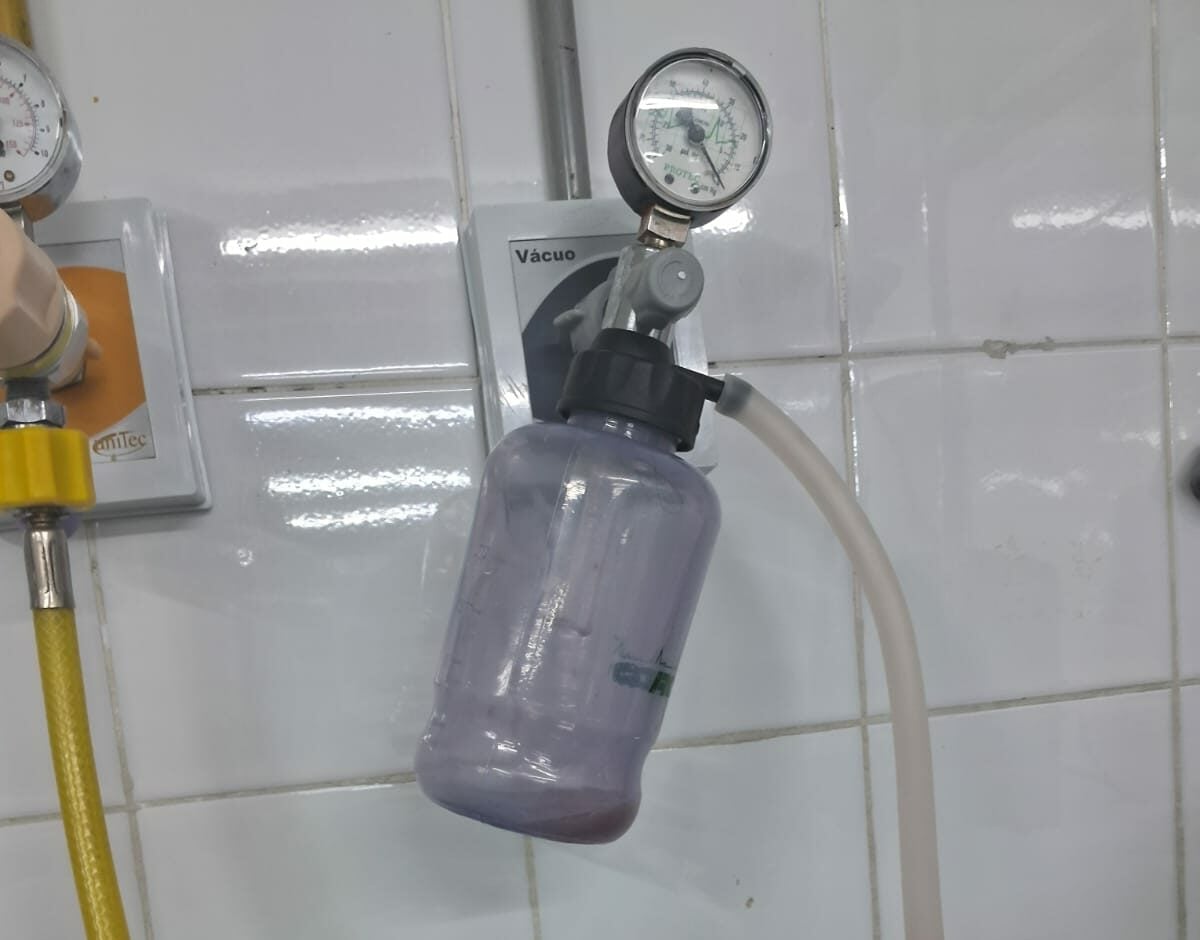 Sindsaúde denuncia falta de equipamento e risco de contaminação em UTIs do Walfredo Gurgel